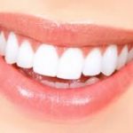 I rimedi naturali per avere denti bianchi