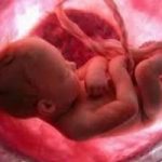 L'ultima frontiera della medicina: il feto si opera in utero