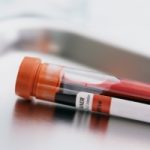 Tumori: addio biopsia, basterà un esame del sangue