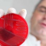 Medicina: la sfida del futuro sono i superbatteri