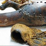 Una protesi di 3000 anni fa