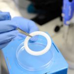 L'anello vaginale contro l'HIV