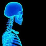 Sindrome della 'testa che scivola sul collo', come riconoscerla e trattarla