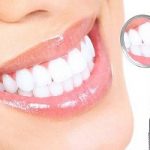 Denti bianchi, con il dentifricio fotovoltaico