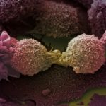 Scoperto starter tumorale: come si formano le metastasi