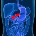 Tumore al pancreas: un derivato della vitamina D per sconfiggerlo