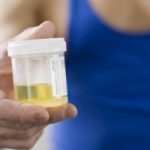 Salute: quattro cose sulle urine che forse non sai