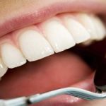 Cinque consigli per denti in salute (oltre a spazzolino e filo interdentale)