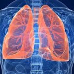 I primi sintomi del cancro ai polmoni