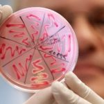 Escherichia coli: cos’è e come avviene il contagio