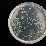 Strani batteri nello spazio