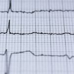 Gli integratori di Omega 3 e gli attacchi di cuore