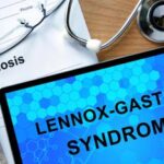 Lo studio, più di 1 anno per una diagnosi di sindrome di Lennox-Gastaut